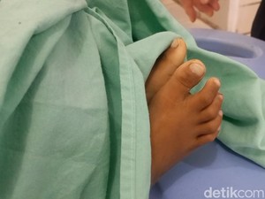Anak 4 Tahun Tewas di Angkot Usai Disiksa Ayah Tiri, Ini 5 Faktanya