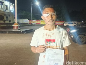 Viral Ketua Bemnus NTT Dipukuli Polisi Saat Demo, Kapolresta Membantah