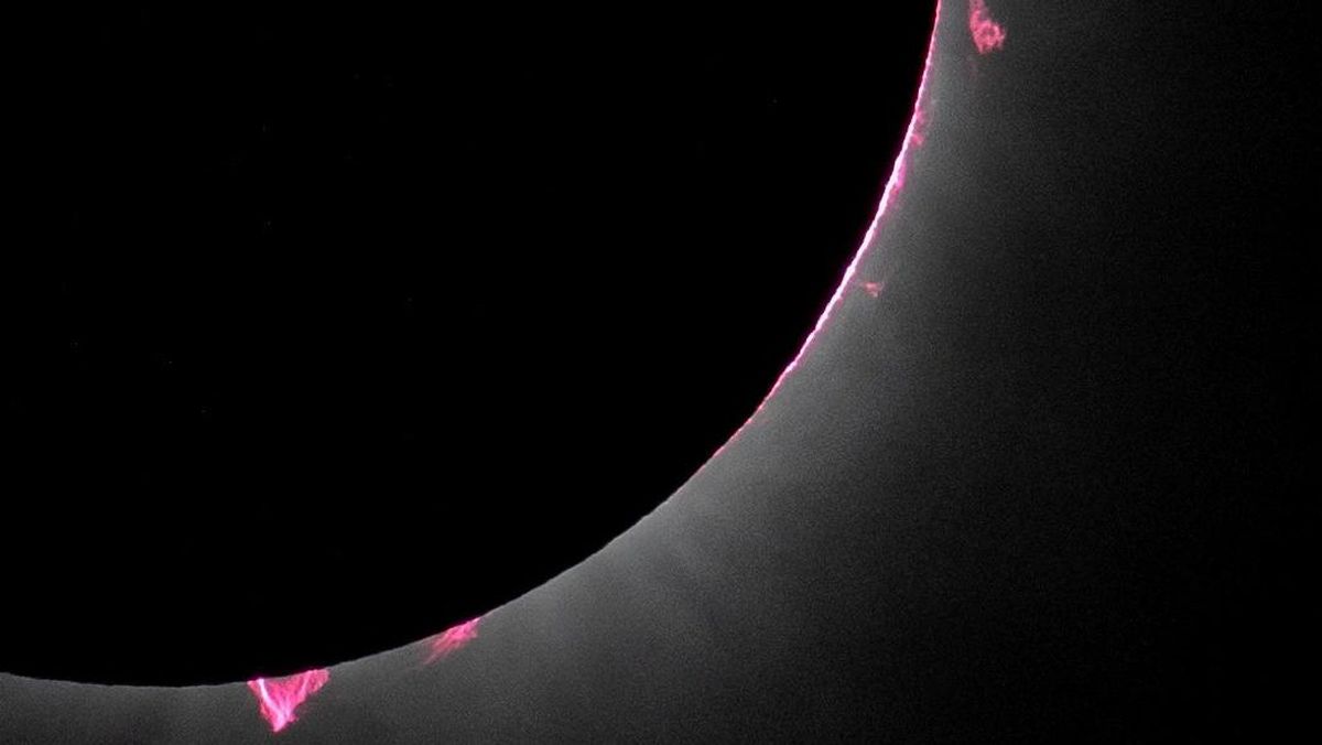 Anal jinsiy aloqa haqida ilmiy faktlar