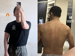 V BTS Pamer Badan Kekar Pasca Wamil, Ada Luka Kebanggaan di Punggung