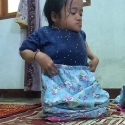 Hadapi Penyakit Tulang Kaca, Anak Guru Honorer Punya Mimpi Jadi Dokter