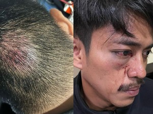 2 Warga Kolaka Sempat Adukan Oknum Polisi ke Senior Sebelum Diduga Dikeroyok