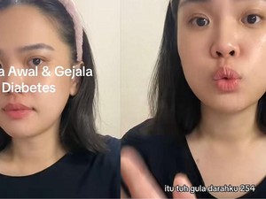Viral Wanita Kena Diabetes di Umur 32, Gula Darahnya Nanjak di Angka 250