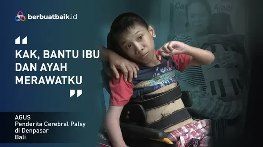 Agus penderita cerebral palsy di Denpasar, Bali. (Dok. Berbuatbaik.id)