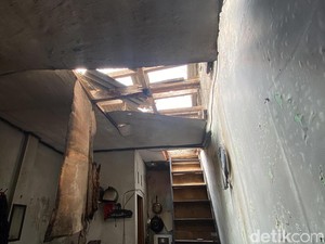 Kondisi Terkini Bocah Korban Gas Meledak di Bandung