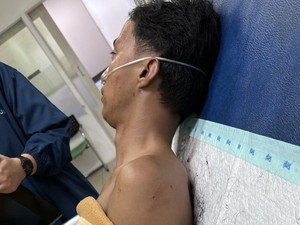 Pria di Belitung yang Ditusuk Sekelompok Pemuda Bantah Geber Motor-Cekcok
