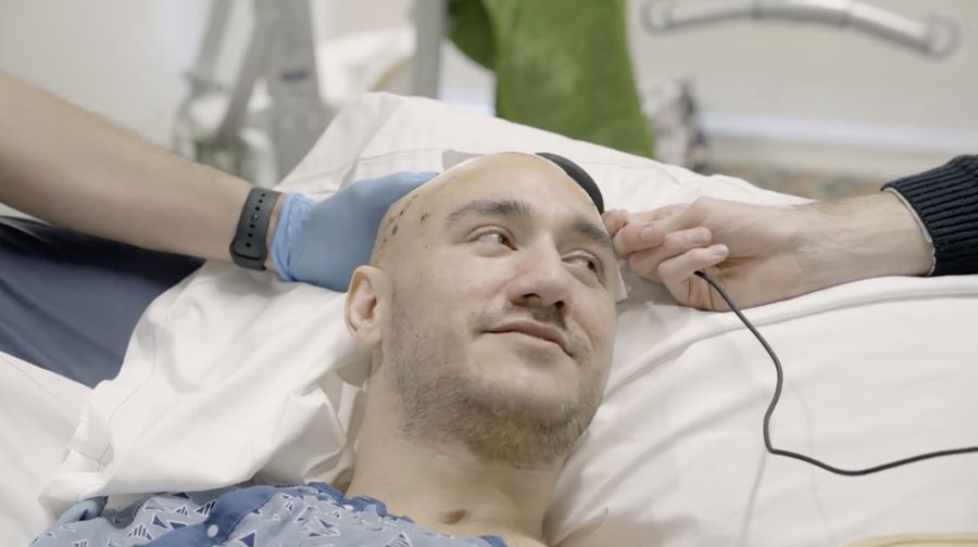 Neuralink buka-bukaan masalah pada proyek implan chip otak ke manusia. Startup milik Elon Musk tersebut mengaku ada kabel kecil yang salah posisi di dalam otak pasien pertamanya. (X @Neuralink)