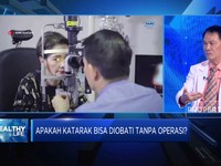 Video: Waspada! Katarak Jadi Penyebab Kebutaan No 1 di Dunia