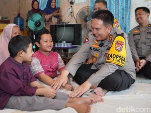 Difasilitasi Irjen Iqbal, Adik-Kakak Penderita Kerapuhan Tulang Berangsur Pulih