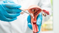 Kata POGI soal Viral Kasus Rahim Copot Pasca Lahiran