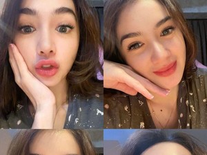 Tujuan Angel Karamoy Operasi Plastik Hidung hingga Terbang ke Korea