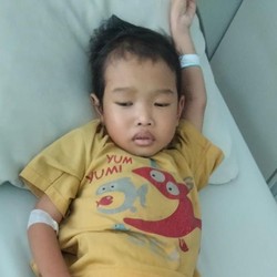 Jafar, Anak Sopir Penderita Kelainan Usus Langka tidak Bisa BAB Normal