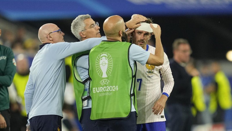Kylian Mbappe dari Prancis mendapat perawatan setelah mengalami cedera saat laga Grup D antara Austria dan Prancis pada turnamen sepak bola Euro 2024 di Duesseldorf, Jerman, Senin, 17 Juni 2024. (AP Photo/Alessandra Tarantino)