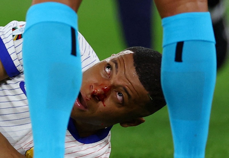 Kylian Mbappe dari Prancis mendapat perawatan setelah mengalami cedera saat laga Grup D antara Austria dan Prancis pada turnamen sepak bola Euro 2024 di Duesseldorf, Jerman, Senin, 17 Juni 2024. Kylian Mbappe dari Prancis mendapat perawatan setelah mengalami cedera saat laga Grup D antara Austria dan Prancis pada turnamen sepak bola Euro 2024 di Duesseldorf, Jerman, Senin, 17 Juni 2024. (AP Photo/Alessandra Tarantino)