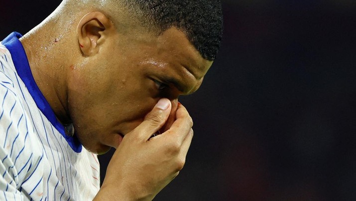 Kylian Mbappe dari Prancis memegangi wajahnya setelah mengalami cedera wajah. (REUTERS/Thilo Schmuelgen)
