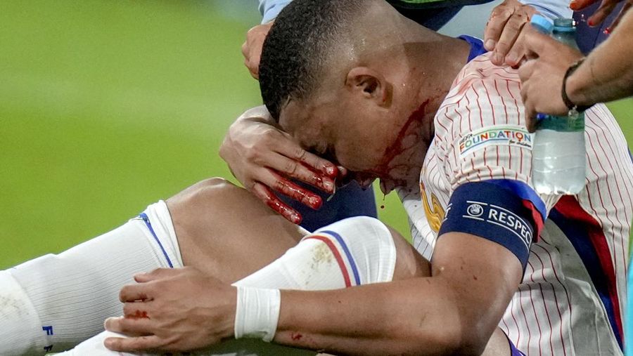 Kylian Mbappe dari Prancis mendapat perawatan setelah mengalami cedera saat laga Grup D antara Austria dan Prancis pada turnamen sepak bola Euro 2024 di Duesseldorf, Jerman, Senin, 17 Juni 2024. (AP Photo/Alessandra Tarantino)