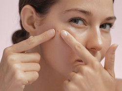 5 Cara Mengatasi Jerawat Hormonal, Dari Skincare hingga Pola Hidup 5 Cara Mengatasi Jerawat Hormonal, Dari Skincare hingga Pola Hidup