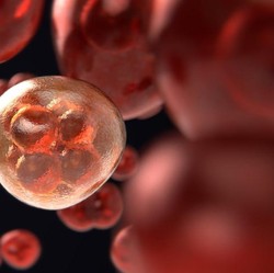 Kanker Ovarium Sulit Dideteksi Dini, Waspadai 4 Gejala Khas Ini