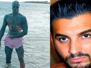 Pria Jalani Modifikasi Tubuh Demi Mirip Alien, Nekat Potong Jari hingga Hidung