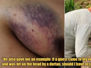 Sedang Asyik Makan Durian, Turis Ini Apes Digigit Anjing