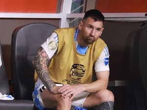Messi Cedera Engkel, Mau Cepat-cepat Balik ke Lapangan!