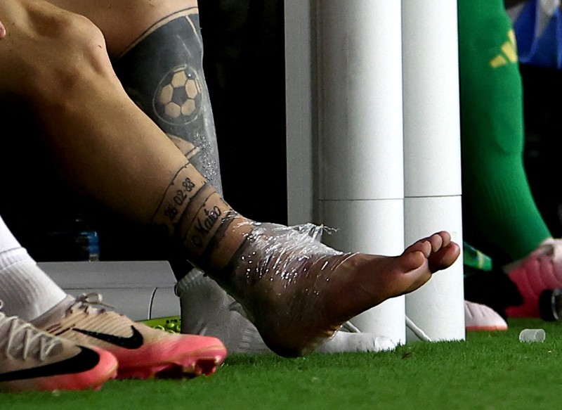 Lionel Messi harus menyudahi aksinya lebih dulu saat Argentina berjuang memenangi Copa America 2024 melawan Kolombia. Messi alami cedera pada kakinya dan harus menonton rekan-rekannya dari pinggir lapangan. (USA TODAY Sports via Reuters Con/Nathan Ray Seebeck) Lionel Messi harus menyudahi aksinya lebih dulu saat Argentina berjuang memenangi Copa America 2024 melawan Kolombia. Messi alami cedera pada kakinya dan harus menonton rekan-rekannya dari pinggir lapangan. (USA TODAY Sports via Reuters Con/Nathan Ray Seebeck)