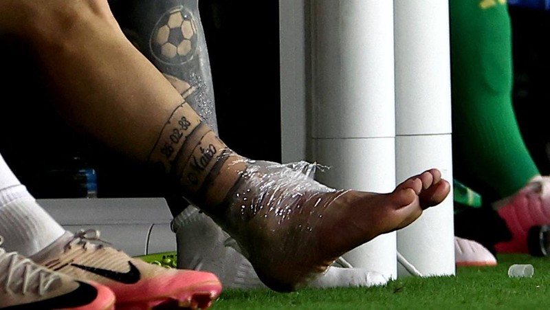 Lionel Messi harus menyudahi aksinya lebih dulu saat Argentina berjuang memenangi Copa America 2024 melawan Kolombia. Messi alami cedera pada kakinya dan harus menonton rekan-rekannya dari pinggir lapangan. (USA TODAY Sports via Reuters Con/Nathan Ray Seebeck)