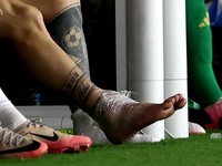 Penampakan Kaki Bengkak yang Bikin Messi Nangis di Copa America