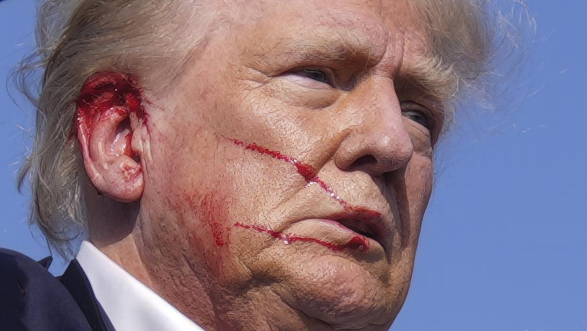 Rusia Berikan Peringatan Terselubung untuk Trump: Bisakah Nasibnya Serupa dengan JFK?