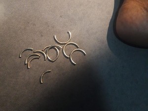 Waduh! Cincin 5 Ulir Nyangkut di Alat Vital Kakek di Jogja