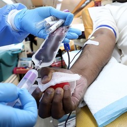 Segini Besaran Biaya Cuci Darah yang Ditanggung BPJS Kesehatan