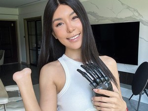 Kisah Tragis Model yang Tangannya Diamputasi, Kini Jadi Robot Cantik