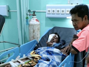 Warga Bangka Selatan Selamat Usai Diterkam Buaya Saat Asyik Mancing