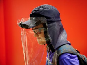 Apa Itu Xeroderma Pigmentosum? Bikin Bocah di Spanyol Tak Bisa Kena Sinar Matahari