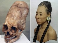 Misteri Tengkorak Lonjong Peru Dikira Alien, Ini Kata Ilmuwan