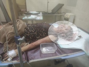 Meliani Warga Prabumulih Dibacok Pacar di Kosan, Diduga Pelaku Cemburu