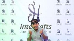 Ikuti Jejak Mathias Muchus-Tanta Ginting Transplantasi Rambut di Indonesia