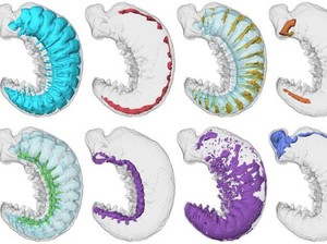 Meski Seukuran Pasir, Larva Ini Mengungkap Evolusi Arthropoda