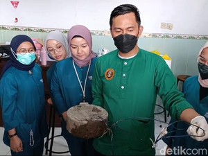 Hasil Visum Ita yang Tewas di Jembatan Pesona, Urat Napas Putus-Hati Robek