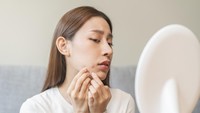 Kulit Berjerawat dan Berminyak Tetap Butuh Pelembap? Cek Isi Gel-Cream Ini