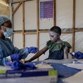 Wajib Tahu! Ini Daftar Gejala Mpox yang Mirip Covid-19