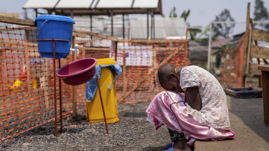 Seorang gadis muda yang menderita mpox menunggu perawatan di sebuah klinik di Munigi, Kongo timur, Jumat, 16 Agustus 2024. (AP Photo/Moses Sawasawa)