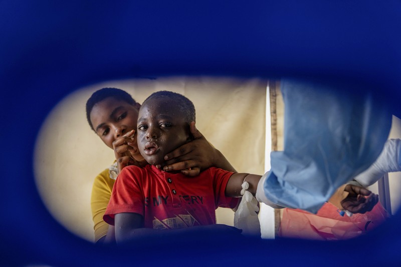 Seorang petugas kesehatan berjalan melewati pusat perawatan mpox di Munigi, Kongo timur, Senin, 19 Agustus 2024. Kongo akan menerima dosis vaksin pertama untuk mengatasi wabah mpox minggu depan dari Amerika Serikat, kata menteri kesehatan negara itu pada Senin, beberapa hari setelah Organisasi Kesehatan Dunia menyatakan wabah mpox di Afrika sebagai keadaan darurat global. (AP Photo/Moses Sawasawa)