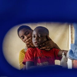 Lengkap! Semua Tentang Mpox, Indonesia Wajib Waspada