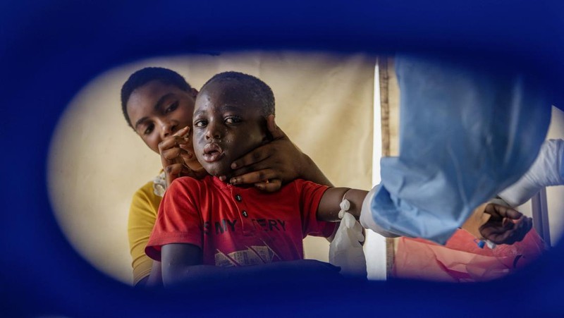 Seorang petugas kesehatan berjalan melewati pusat perawatan mpox di Munigi, Kongo timur, Senin, 19 Agustus 2024. Kongo akan menerima dosis vaksin pertama untuk mengatasi wabah mpox minggu depan dari Amerika Serikat, kata menteri kesehatan negara itu pada Senin, beberapa hari setelah Organisasi Kesehatan Dunia menyatakan wabah mpox di Afrika sebagai keadaan darurat global. (AP Photo/Moses Sawasawa)