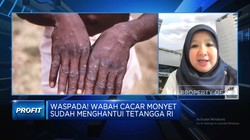Video: Waspada! Wabah Cacar Monyet Menghantui, Banyak Dialami Pria Gay