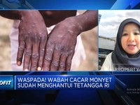 Video: Waspada! Wabah Cacar Monyet Menghantui, Banyak Dialami Pria Gay