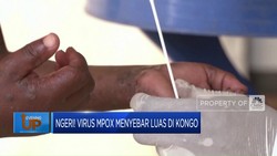 Video: Ngeri! Virus Mpox Menyebar Luas di Kongo