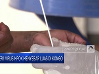 Video: Ngeri! Virus Mpox Menyebar Luas di Kongo