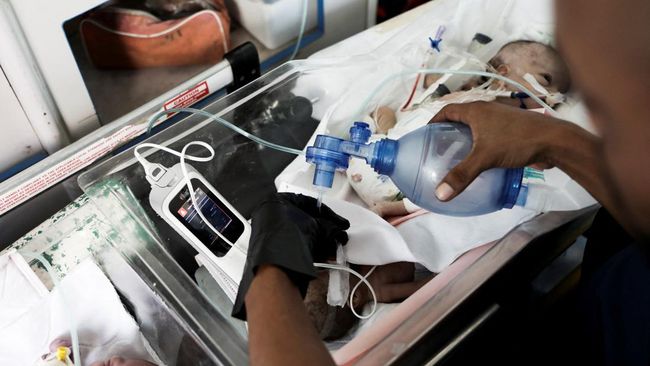 Tanda Kiamat Sudah Dekat, Makin Banyak Anak Lahir Prematur